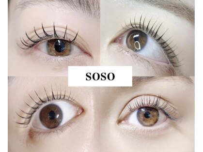 ソソ(soso)の写真