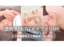 ウィロー