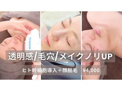 ウィローの写真