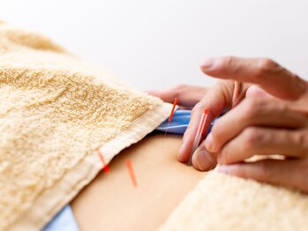 狭山池尻みやび鍼灸マッサージ院の写真/【介護や力仕事で腰がつらい方に】毎日をもっと快適に★本格鍼灸×マッサージで腰ラク♪