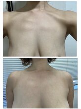 シャルマン(Charmant)/befoer、after