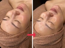 ナチュラックスビューティー 恵比寿店(NaturaxBeauty)の雰囲気（ララピールで速攻ツヤ肌★【ツヤ肌/毛穴ケア/白玉肌】）