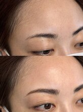 マナ ワクシング 海浜幕張(Mana waxing)/おでこwax/フェイシャルワックス