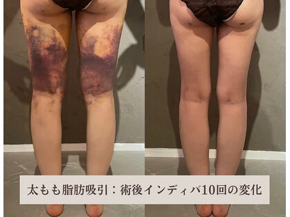 エッセンスビー 六本木(Essence Be)の写真