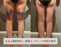 エッセンスビー 六本木