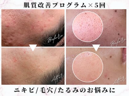 オレンジ(Orange)の写真