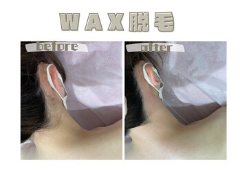 レヴィート(Revept)/【ワックス脱毛】