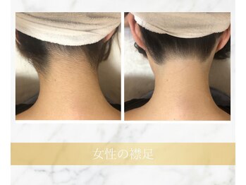 アンド エヌ(&n)/◆襟足脱毛◆