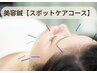【スポットケア】ほうれい線や目元など特定部位を集中的にケア☆美容鍼☆30本