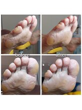 爪切り屋 足楽/