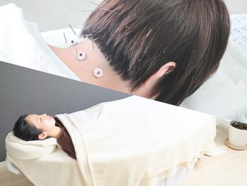 アーチ(Arch)の写真/【女性向けプライベート鍼灸院】デトックス効果の高い寝ながらよもぎ蒸し＋鍼灸メニューが大阪ではレア施術