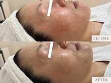 クラームビューティー(Clerm beauty)/【40代 女性】鎮静フェイシャル