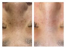 ビジュツ(BIJYUTSU)/