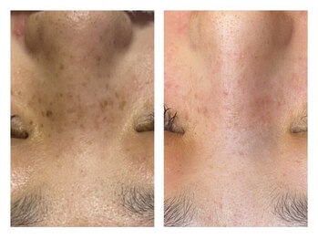 ビジュツ(BIJYUTSU)/