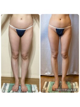 アクアモア/アクアモアの痩身★BeforeAfter