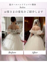 ルビン(Rubin)/ブライダルエステBefore/After