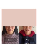 かぐや(salon)/ビフォアフ：「香り蒸」後の施術