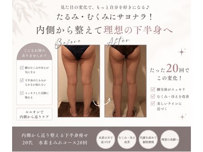 ヨサパーク ル フェルナ(YOSA PARK Le Ferna)の写真
