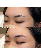 フレイズラピス(FRASE Lapis)/【ハリウッドブロウリフト】