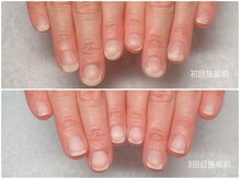 ムーン(Mooooon)の雰囲気（深爪 手荒れ 爪と手肌のお悩みにネイルケア/自爪ケア/爪育成）