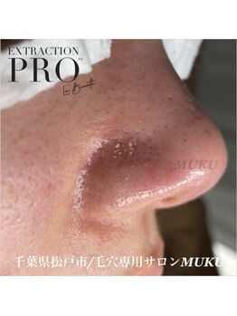 ムク(MUKU)/毛穴詰まりから解放