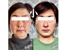 フレキシボディ(FlexiBody)の雰囲気（小顔になるの諦めてませんか？Minoruの小顔整体にお任せください）