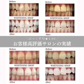 ホワイトニングショップ 宇治店