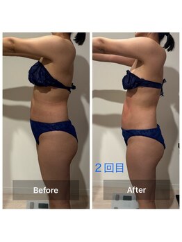 ユーフォリアプラス(euphoria +plus)/くびれ