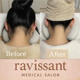 ラヴィソン(ravissant)