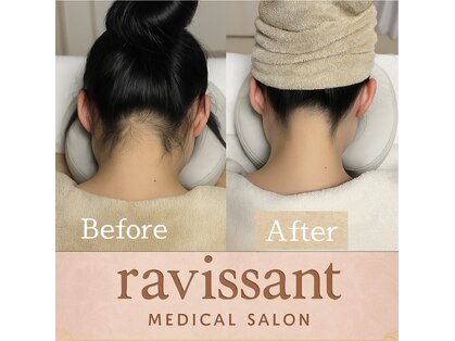 ラヴィソン(ravissant)の写真