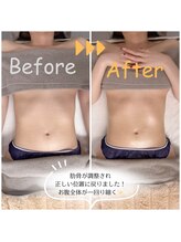 スリモア(SLIMORE)/ビフォーアフター☆お腹