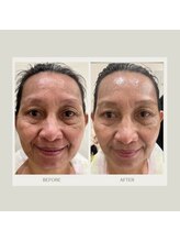 ダナビューティ 練馬桜台店(DANA BEAUTY)/ビフォーアフター