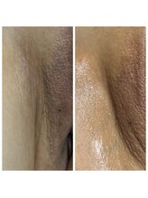 アットユウ(@yu)/フェムエステ