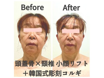 マルウル(maluulu)の写真