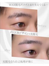 リノア(Linoa)/メンズ眉毛ビフォーアフター