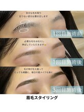 アイディアル(eyedeal)/サロンケアの経過です♪<眉毛>