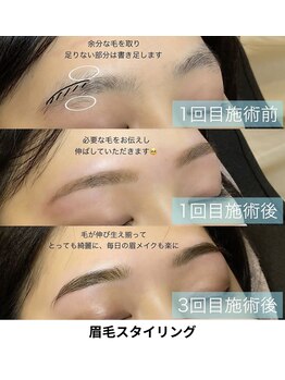 アイディアル(eyedeal)/サロンケアの経過です♪<眉毛>
