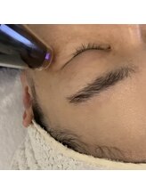 スキン ラボ ケー(Skin lab K)/低温プラズマ+リジュランケア