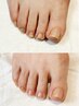 【FOOT】たこ、魚の目、足裏角質むくみを解消！足のトータルフットケア♪