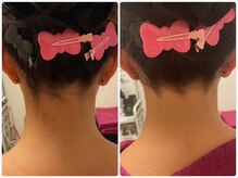 エステサロン ジジ 新宿(JIJI)/ソフトシェービング例2（襟足）