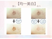 サイ(Sai)の雰囲気（おシミのあるお肌と、健康なお肌。同時にトーンアップ！）