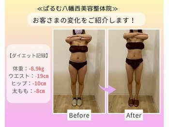 ぱるむ八幡西美容整体院/☆ダイエット☆