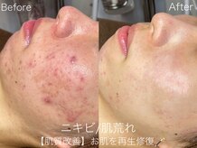 ラティーナ(Lattina)