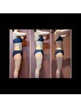 ナコズ エステティック(Nakos esthetic)/ブライダル3回コース♪