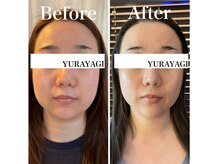 小顔屋ゆらやぎ