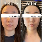 小顔屋ゆらやぎ