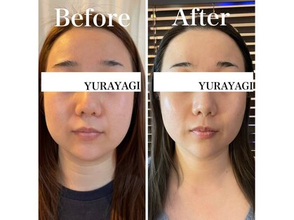 小顔屋ゆらやぎの写真