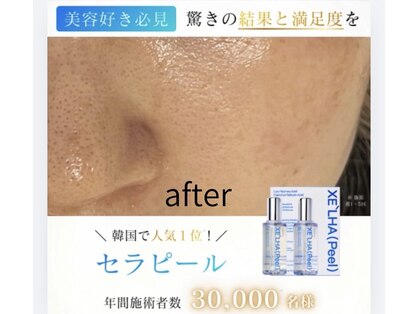 ポリー(Polly)の写真