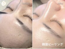 プリュボーテ(Pul Beaute)/ぷるっとした潤いある肌を目指す
