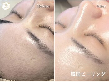 プリュボーテ(Pul Beaute)/ぷるっとした潤いある肌を目指す
